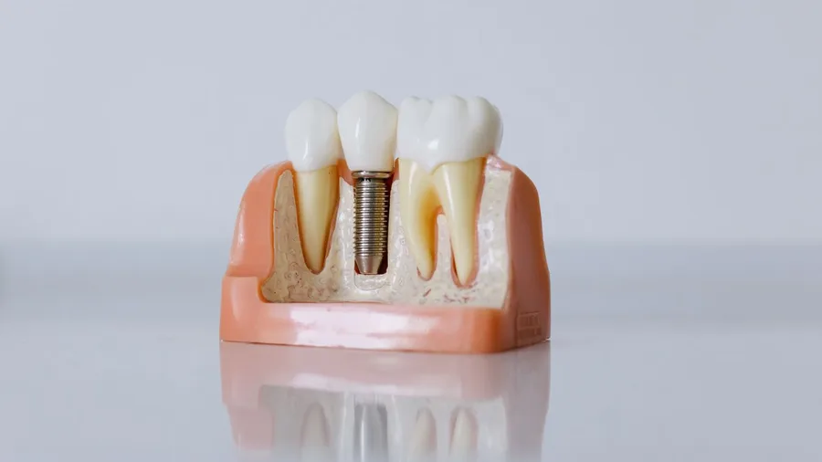 Dental, vision, and hearing add costs outside premiums